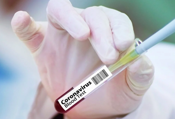     Коронавирус в Украине - вакцину от Covid-19 получит 20% населения - коронавирус новости    