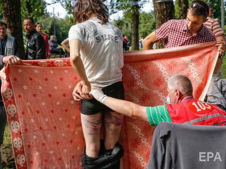 "Травмы тяжелее, чем мы ожидали". Чехия приняла на лечение более 40 белорусов, пострадавших во время протестов