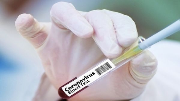 В Киеве за сутки коронавирусом заразились более 1,7 тыс. человек, в том числе 69 медиков